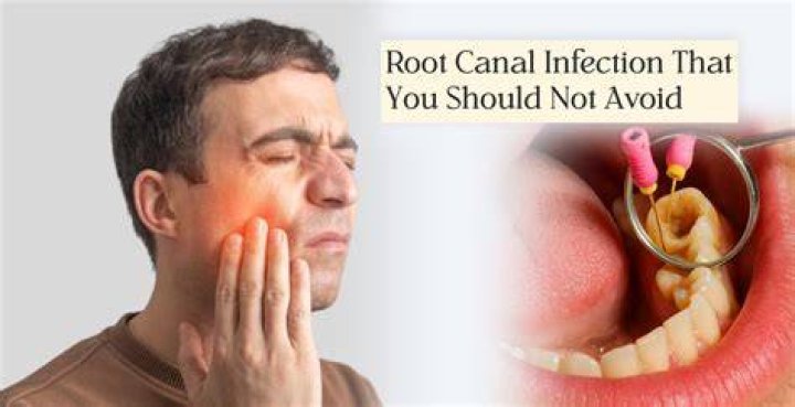 Does crown after root canal hurt?