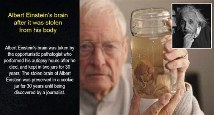 Was Albert Einstein brain stolen when he died?