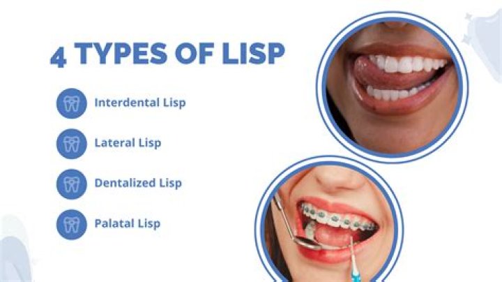 When does a lisp go away?